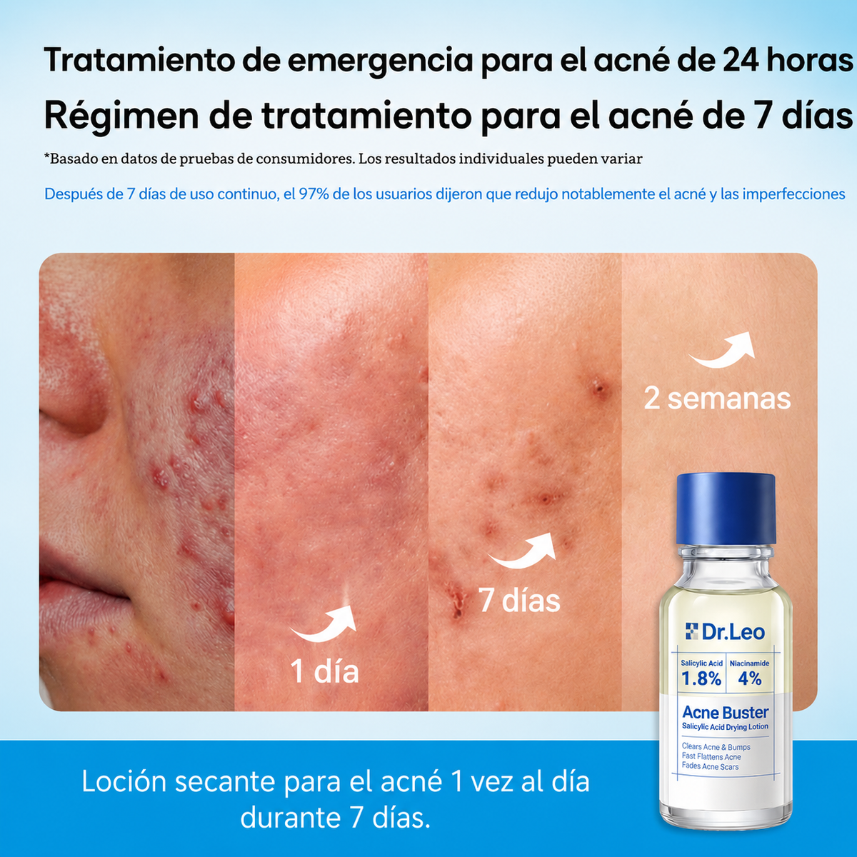 Loción Secante para Granos con Ácido Salicílico 1.8% – Tratamiento Puntual Antiacné